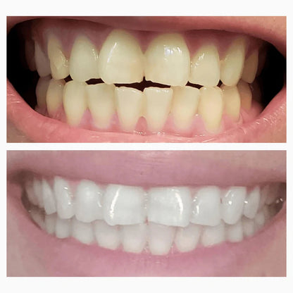 Magic Whitening Toothpaste Booster